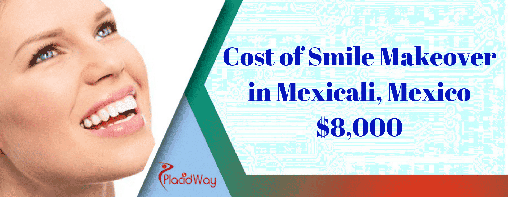 Cost of Smile Makeover in Mexicali, Mexico Cost of Smile Makeover in Mexicali, Mexico